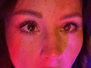 MedeaAllure Image Gallery